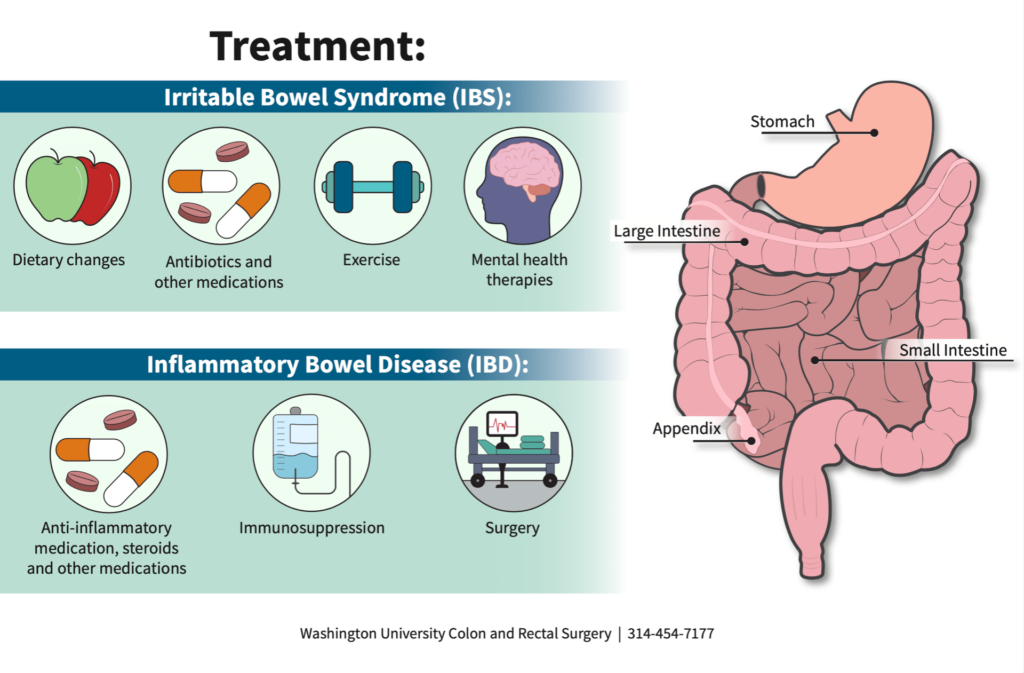 Diagnosing Treating Bowel Disorders